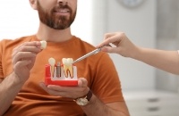 Dentist showing a model of a dental implant to a patient