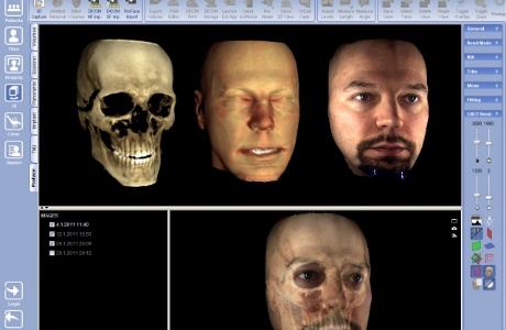 Digital models of a persons skull and face
