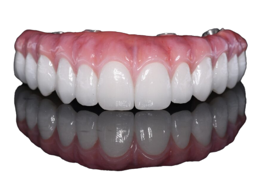 XircOn implant denture against white background