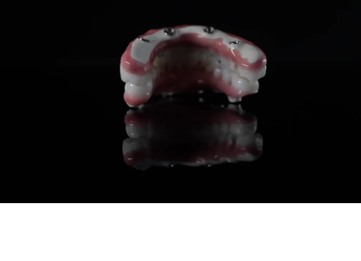 XircOn implant denture against black background