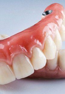 An All-on-4 Dental Implant