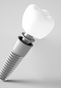 A single tooth dental implant